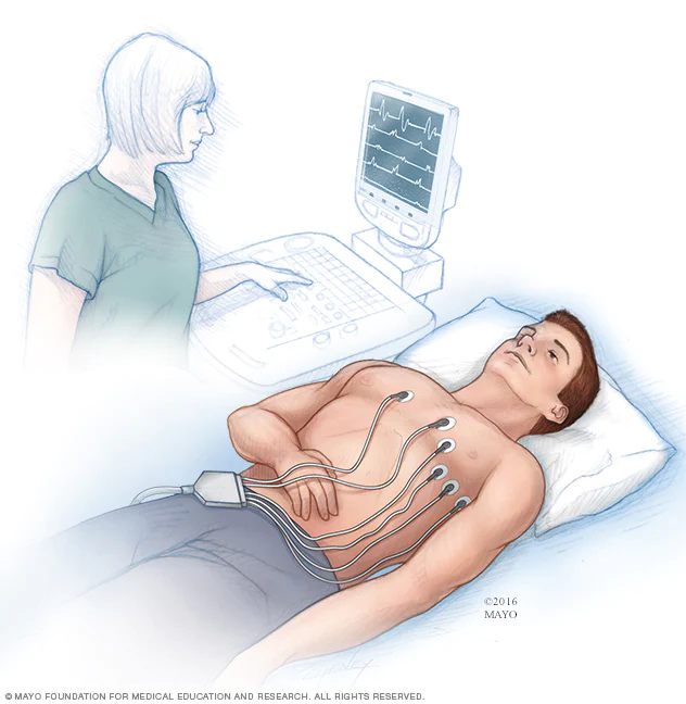 Best ECG test Lab